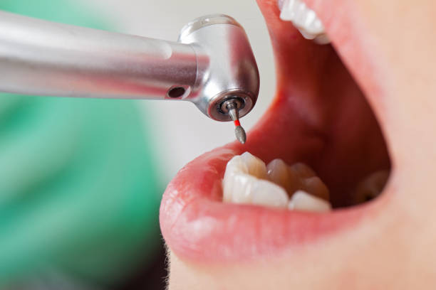 Best Mobile Emergency Dentist in Blue Hills, CT